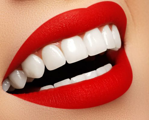 مراقبت های بعد از کامپوزیت دندان در اهواز